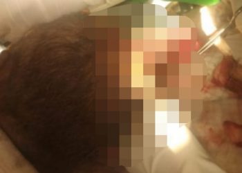 Pelaku Kasus Percobaan Pembunuhan Di Manggarai Barat Belum Ditangkap Polisi