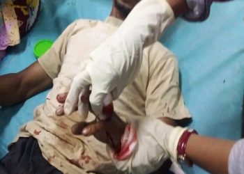 Jadi Tersangka, Pelaku Pembacokan di Wela Diancam Hukuman Lima Tahun