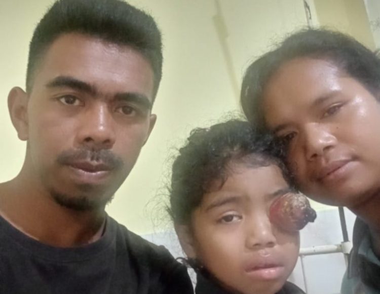 Kanker Mata Menimpa Bocah Berusia Enam Tahun Butuh Uluran Tangan Penderma