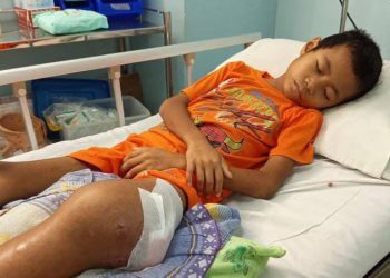 Bocah Yatim Piatu Asal Boleng Menderita Kanker Tulang dan Diamputasi, Butuh Bantuan Biaya Perawatan