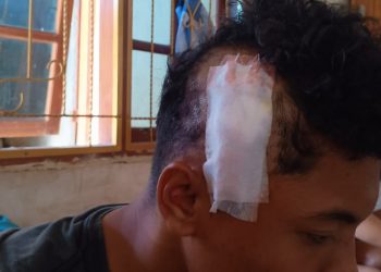 Polres Mabar Selidiki Kasus Pembacokan Terhadap Pelajar SMKN di Puncak Waringin