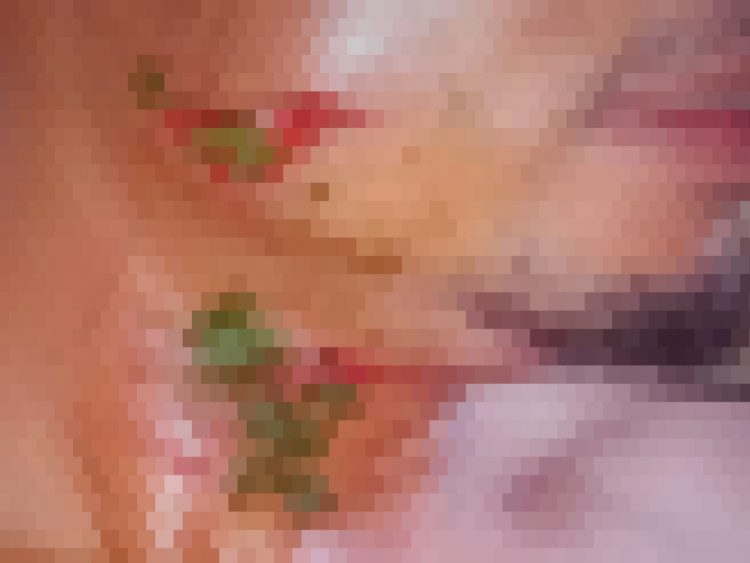 Kuasa Hukum Korban Pengeroyokan di Lewur-Kuwus Minta Polres Mabar Segera Tangkap Para Pelaku