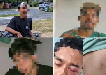 Terungkap Jumlah Pelaku Pengeroyokan di Mbarata, Keluarga Korban Telah Mengantongi Tiga Nama