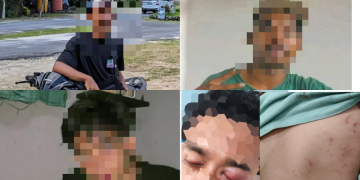 Terungkap Jumlah Pelaku Pengeroyokan di Mbarata, Keluarga Korban Telah Mengantongi Tiga Nama 