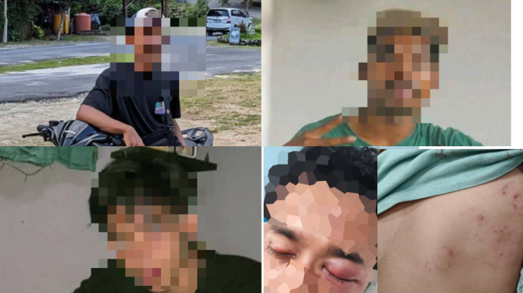 Terungkap Jumlah Pelaku Pengeroyokan di Mbarata, Keluarga Korban Telah Mengantongi Tiga Nama