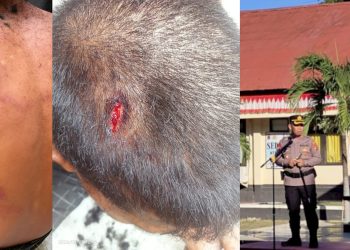 Oknum Buser Polres Mabar Diduga Aniaya Remaja Di Bawah Umur Hingga Luka Lebam di Sekujur Tubuh