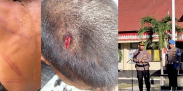 Oknum Buser Polres Mabar Diduga Aniaya Remaja Di Bawah Umur Hingga Luka Lebam di Sekujur Tubuh