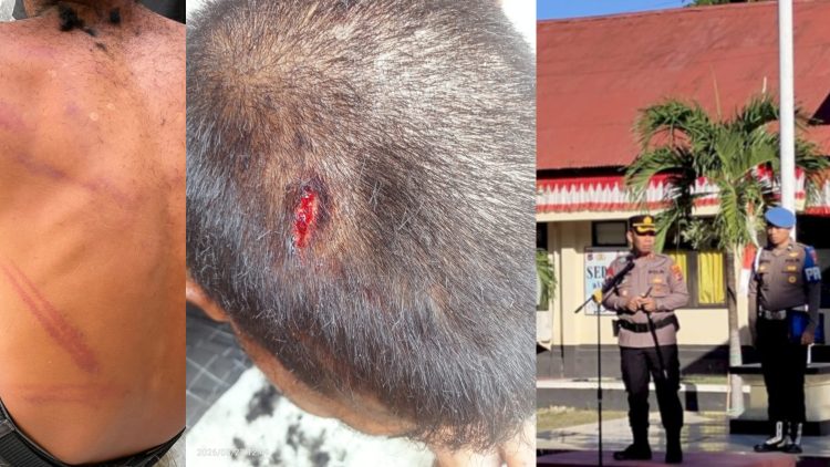 Oknum Buser Polres Mabar Diduga Aniaya Remaja Di Bawah Umur Hingga Luka Lebam di Sekujur Tubuh