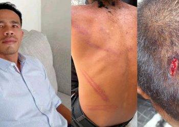 Jejak Memar di Ruang Resmob: Oknum Anggota Polres Mabar Dipolisikan Orang Tua Korban