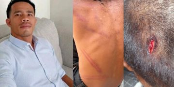 Jejak Memar di Ruang Resmob: Oknum Anggota Polres Mabar Dipolisikan Orang Tua Korban