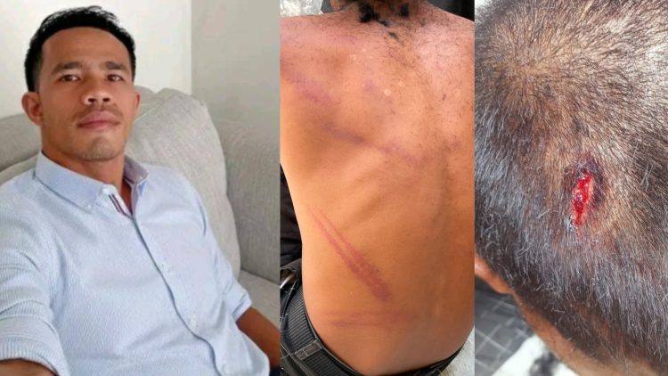 Jejak Memar di Ruang Resmob: Oknum Anggota Polres Mabar Dipolisikan Orang Tua Korban