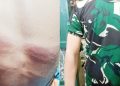 Brutal ! Oknum Anggota TNI AD Tega Hajar Pelajar 17 Tahun Pakai Selang, Pihak Berwenang Pilih Bungkam