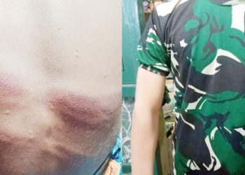 Brutal ! Oknum Anggota TNI AD Tega Hajar Pelajar 17 Tahun Pakai Selang, Pihak Berwenang Pilih Bungkam