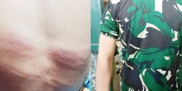 Brutal ! Oknum Anggota TNI AD Tega Hajar Pelajar 17 Tahun Pakai Selang, Pihak Berwenang Pilih Bungkam