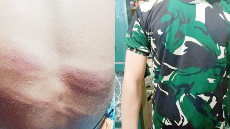 Brutal ! Oknum Anggota TNI AD Tega Hajar Pelajar 17 Tahun Pakai Selang, Pihak Berwenang Pilih Bungkam