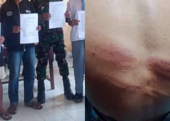 Kasus Dugaan Penganiayaan Pelajar oleh Oknum TNI AD di Manggarai Barat Berakhir Damai di Tengah Bekas Luka yang Belum Pulih