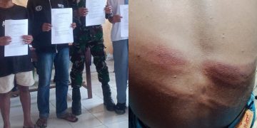Kasus Dugaan Penganiayaan Pelajar oleh Oknum TNI AD di Manggarai Barat Berakhir Damai di Tengah Bekas Luka yang Belum Pulih