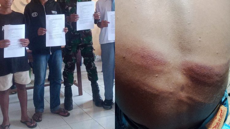 Kasus Dugaan Penganiayaan Pelajar oleh Oknum TNI AD di Manggarai Barat Berakhir Damai di Tengah Bekas Luka yang Belum Pulih